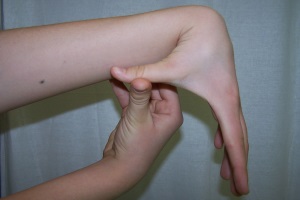 Синдром гіпермобільності суглобів у дітей та підлітків
