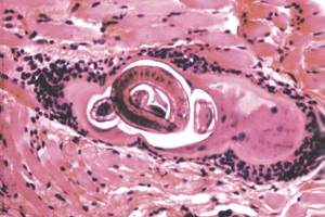 Роль и место тканевых паразитозов в патологии человека