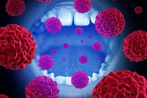 Клінічні рекомендації CDC щодо ведення пацієнтів, інфікованих вірусом папіломи людини