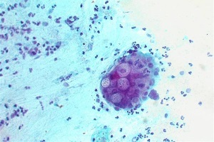 Захворювання, викликані Chlamydia trachomatis
