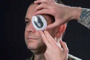 Рваная травма глаза с выпадением или утратой внутриглазных тканей