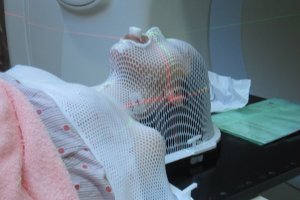 Лучевая терапия: невысказанные проблемы