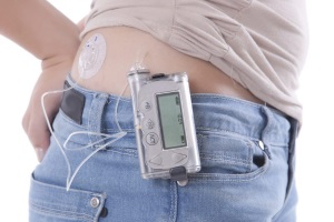 Инсулиновые помпы: как  обеспечить лучшие результаты гликемического контроля?