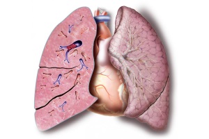 Тромбоемболія легеневих артерій: де ми знаходимося на початку ХХІ століття?