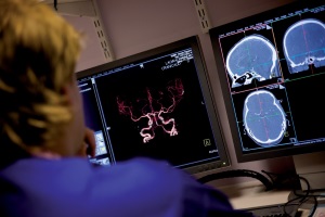 Інтенсивна терапія гострого мозкового інсульту в умовах спеціалізованого відділення