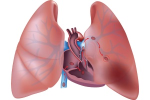Тромбоэмболия легочной артерии: современные принципы диагностики и лечения