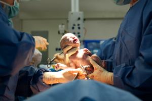 Расслоение аорты после родов