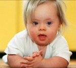ЭКО повышает риск рождения ребенка с синдромом Дауна?