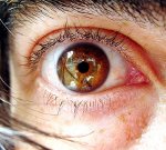 Контактные линзы: как помочь глазам и при этом не навредить