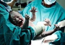 Позднее пережатие пуповины – профилактика анемии у новорожденных