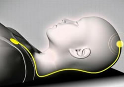 Редкий наследственный недуг теперь лечат микроэлектродами в мозге