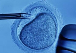 Рекорд: зачатие спермой 22-летней давности