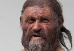 Цивилизация не виновата: наши предки болели атеросклерозом еще 5 000 лет назад
