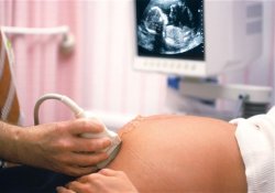 За неудачный аборт гинеколог будет платить алименты