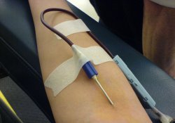 Средневековые врачи были правы: «кровопускание» полезно для гипертоников