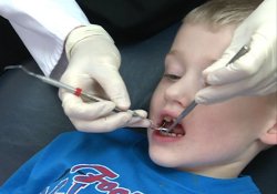 Как зубные пломбы могут влиять на психику детей
