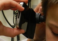 Насадка на камеру смартфона позволит удаленно дитагностировать заболевания уха