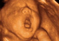 Если малыш в материнской утробе зевает – это хорошо