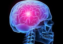 Сочетание радиотерапии и специальной диеты эффективно при лечении опухолей мозга