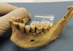 Доисторические предки питались хуже, но зубы у них были лучше