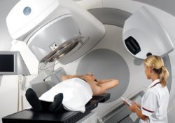 Открытие ученых поможет облегчить побочные эффекты радиотерапии