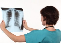 Рентгеновские снимки, снабженные фотопортретом больного, уменьшат число врачебных ошибок
