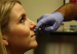 Новый метод диагностики шизофрении: маркеры болезни «прячутся» в носу