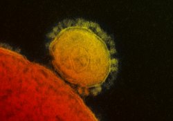 MERS не SARS: ученые подводят первые итоги изучения нового коронавируса
