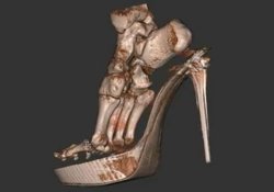 Снимок женских ножек в туфлях на «шпильках» ужаснул ученых