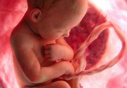 Успехи шведской медицины и рост числа абортов