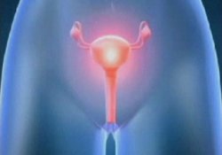 Швеция: уникальные операции по пересадке матки поставлены на поток