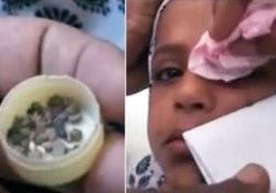 Медики в тупике: йеменская девочка-подросток плачет каменными слезами
