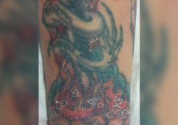 Аллергическая бомба замедленного действия, или язвы 20 лет спустя