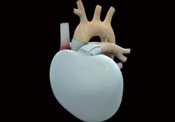 Сбой искусственного сердца – операции приостановлены