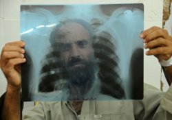 Туберкулез победим: грандиозные планы ВОЗ