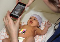 Желтуху новорожденных диагностирует смартфон