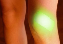 Зеленый – цвет тревоги: «умная» хирургическая повязка выявляет нагноение раны