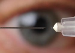 Внутриглазные инъекции «невидимыми» иглами: лечение глаукомы без помощи капель