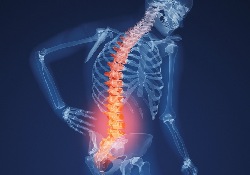 Полезные знания из области медицины: 3 малоизвестных факта об остеопорозе