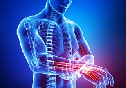 Электроника против артрита: боли в суставах устраняет имплантируемый диск