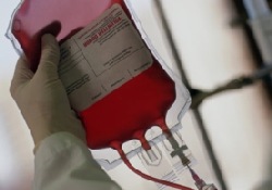 Эффективность переливания крови при лихорадке Эбола: «новые старые данные»