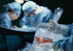 Трансплантологи впервые использовали для пересадки органы младенца