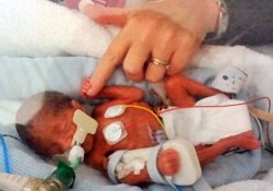 5 близнецов китаянка зачала и выносила без помощи медиков