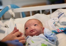В США родился мальчик без носа – малыш выжил, несмотря на тяжелую аномалию