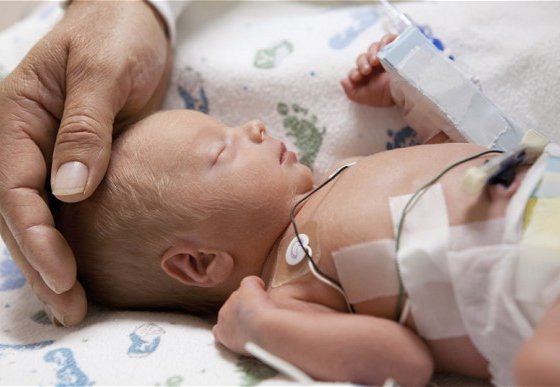 Печальный рекорд: донором органов стал малыш в возрасте… 100 минут