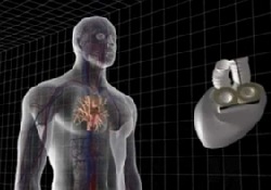 Французские кардиохирурги «снабдили» искусственным сердцем уже третьего больного