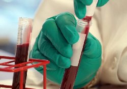 Испытания нового препарата от гемофилии успешно завершены