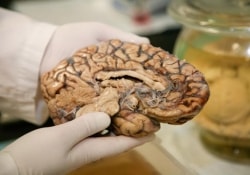 Крупнейшая коллекция образцов человеческого мозга «справила новоселье»