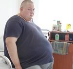 Желудочное шунтирование опасно для людей, страдающих от ожирения