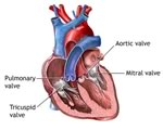 Сердечные клапаны будут менять без операции